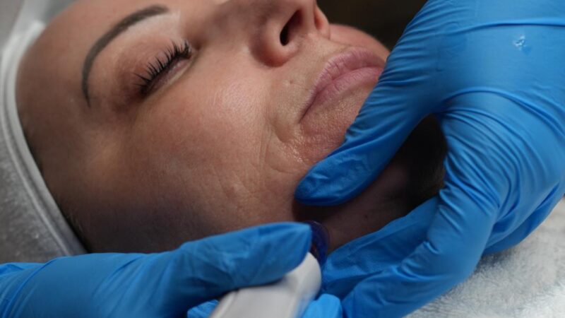 Aqua Facial behandlung Radebeul, Nicole-Trautmann-gerät