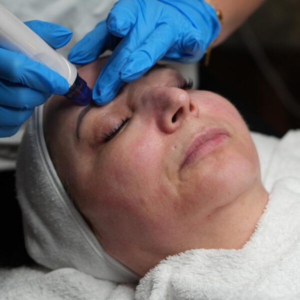 Nicole-Trautmann. Aqua Facial behandlung Radebeul