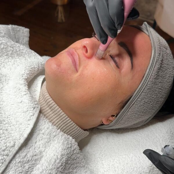 Nicole-Trautmann. Microneedling Radebeul