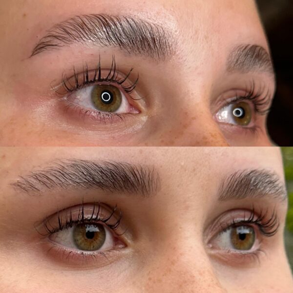 Nicole-Trautmann. Augenbrauenlifting Radebeul