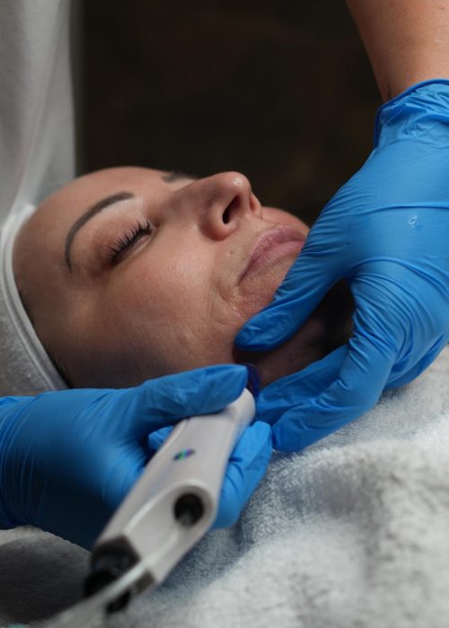 Aqua Facial behandlung Radebeul, Nicole-Trautmann-gerät