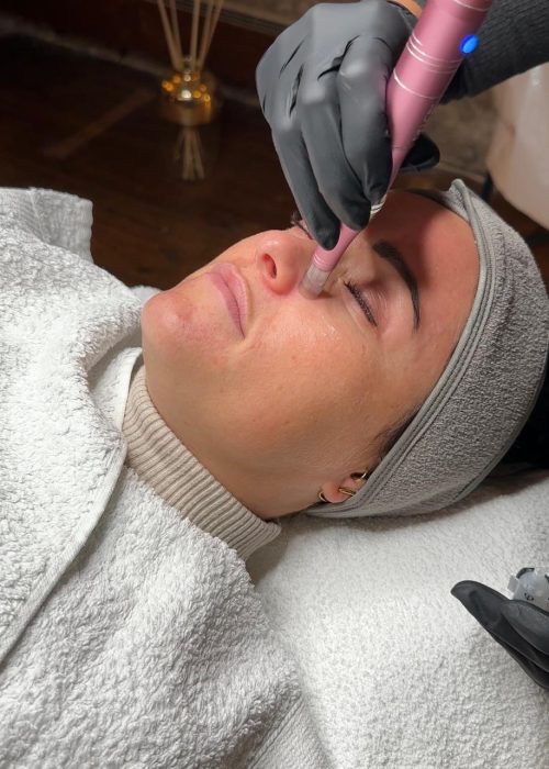 Nicole-Trautmann. Microneedling Radebeul